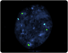 abnl-blast abnl-blast