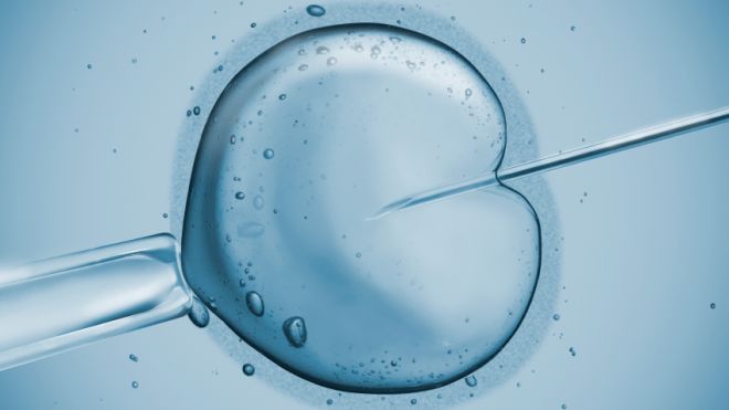 IVF Treatment